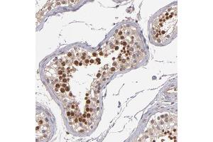 Immunohistochemical staining of human testis with ABHD12B polyclonal antibody  shows strong nuclear positivity in cells of seminiferus ducts at 1:200-1:500 dilution. (ABHD12B anticorps)