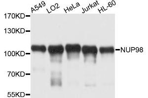 Western blot analysis of extracts of various cell lines, using NUP98 antibody (ABIN5970195) at 1/1000 dilution. (NUP98 anticorps)