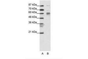 Image no. 1 for anti-General Transcription Factor IIF, Polypeptide 1, 74kDa (GTF2F1) (N-Term) antibody (ABIN6736098) (GTF2F1 anticorps  (N-Term))