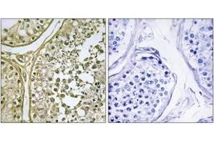 Immunohistochemistry analysis of paraffin-embedded human testis tissue, using CKI-alpha1/L Antibody. (CSNK1A1L anticorps  (AA 141-190))