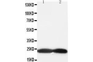 Anti-BAK antibody, Western blotting All lanes: Anti BAK  at 0. (BAK1 anticorps  (Middle Region))