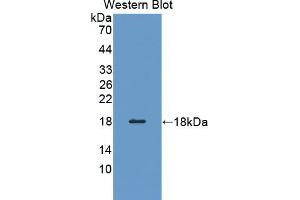 Western blot analysis of the recombinant protein. (Profilin 3 anticorps  (AA 1-133))