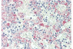 Rabbit Anti-Clec1b antibody  Formalin Fixed Paraffin Embedded Tissue: Human Fetal Liver Primary antibody Concentration: 1:50 Secondary Antibody: Donkey anti-Rabbit-Cy3 Secondary Antibody Concentration: 1:200 Magnification: 20x Exposure Time: 0.