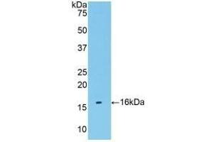 Detection of Recombinant TMEM27, Human using Polyclonal Antibody to Transmembrane Protein 27 (TMEM27)