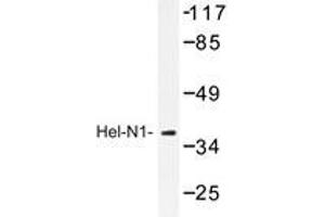Western blot analysis of Hel-N1 antibody in extracts from HepG2 cell. (ELAVL2 anticorps)