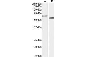 ABIN6391375 (2µg/ml) staining of Mouse (A) and Rat (B) Testes lysate (35µg protein in RIPA buffer).