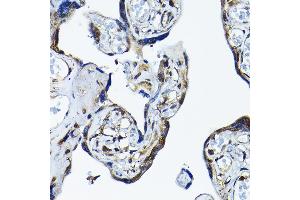 Immunohistochemistry of paraffin-embedded human placenta using PRMT5 Rabbit pAb (ABIN3022065, ABIN3022066, ABIN3022067 and ABIN6218592) at dilution of 1:200 (40x lens).