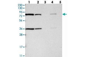 Western blot analysis of Lane 1: RT-4, Lane 2: U-251 MG, Lane 3: Human Plasma, Lane 4: Liver, Lane 5: Tonsil with HSD17B4 polyclonal antibody  at 1:250-1:500 dilution. (HSD17B4 anticorps)