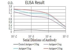 Black line: Control Antigen (100 ng), Purple line: Antigen(10 ng), Blue line: Antigen (50 ng), Red line: Antigen (100 ng), (HDAC2 anticorps  (AA 217-327))