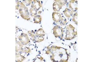 Immunohistochemistry of paraffin-embedded human stomach using RBP2 antibody (ABIN5974059) at dilution of 1/100 (40x lens). (RBP2 anticorps)