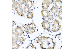 Immunohistochemistry of paraffin-embedded human stomach using RBP2 antibody (ABIN5974059) at dilution of 1/100 (40x lens).