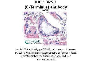 Image no. 1 for anti-Bombesin-Like Receptor 3 (BRS3) (C-Term) antibody (ABIN1732417) (BRS3 anticorps  (C-Term))