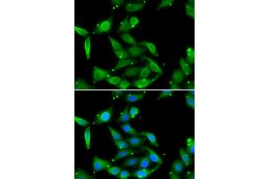 Immunofluorescence analysis of U2OS cells using GAMT antibody (ABIN5973964).