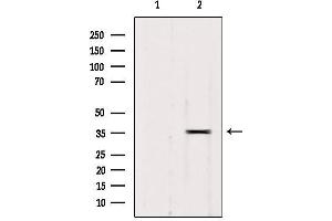 Western blot analysis of extracts from 293, using RALY Antibody. (Raly anticorps  (Internal Region))