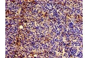 Immunohistochemistry of paraffin-embedded human lymph node tissue using ABIN7155567 at dilution of 1:100 (HLA-C anticorps  (AA 200-306))