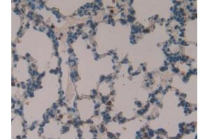 DAB staining on IHC-P; Samples: Rat Lung Tissue (TOR2A anticorps  (AA 34-293))