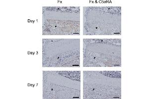 Immunostaining of IL-6 on day 1, 3 and 7 in tissue sections of control animals (Fx) and after administration of C5aRA (Fx & C5aRA) showing the callus region in detail (fracture gap on the left, cortex in the middle, bone marrow on top (*) and periosteal callus (#) on the bottom of the image.