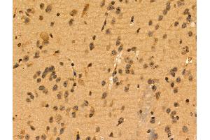 ABIN6257271 and ABIN6274269 at 1/100 staining Mouse brain tissue by IHC-P. (MEOX2 anticorps  (Internal Region))