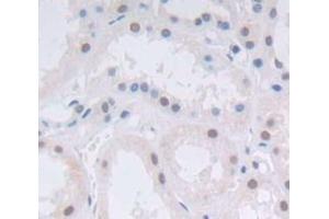 Used in DAB staining on fromalin fixed paraffin- embedded Kidney tissue (Achaete Scute Complex Like Protein 1 (AA 84-236) anticorps)
