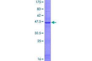 Image no. 1 for Solute Carrier Family 25, Member 28 (SLC25A28) (AA 1-177) protein (GST tag) (ABIN1320281)