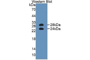 Detection of Recombinant a1AGP, Mouse using Polyclonal Antibody to Alpha-1-Acid Glycoprotein (a1AGP)