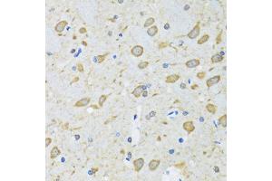 Immunohistochemistry of paraffin-embedded mouse brain using ATG7 antibody. (ATG7 anticorps)