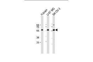 All lanes : Anti-DYNC1LI2 Antibody (Center) at 1:2000 dilution Lane 1: Human brain lysate Lane 2: U-87 MG whole cell lysate Lane 3: SK-OV-3 whole cell lysate Lysates/proteins at 20 μg per lane.