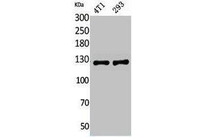 Western Blot analysis of 4T1, 293 cells using Integrin αD Polyclonal Antibody. (ITGAD anticorps  (Internal Region))