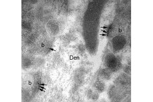 Electron micrograph of L21/32 hippocampal labelling using a post-embedding immunogold method.