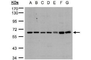 WB Image Sample(30μg whole cell lysate) A: 293T B: A431 , C: H1299 D: HeLa S3 , E: Hep G2 , F: MOLT4 , G: Raji , 7.