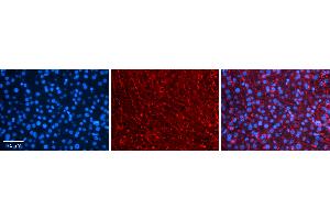 Rabbit Anti-COPS2 Antibody   Formalin Fixed Paraffin Embedded Tissue: Human Liver Tissue Observed Staining: Cytoplasm in hepatocytes and endothelial cells in sinusoids Primary Antibody Concentration: 1:100 Other Working Concentrations: 1:600 Secondary Antibody: Donkey anti-Rabbit-Cy3 Secondary Antibody Concentration: 1:200 Magnification: 20X Exposure Time: 0.