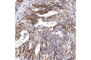 IHC analysis of Rab4/RAB4A using anti-Rab4/RAB4A antibody (ABIN7599733). (Rab4 anticorps  (AA 110-216))