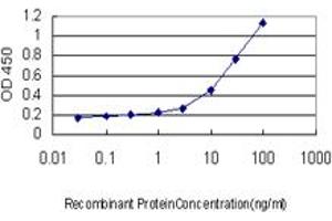 Detection limit for recombinant GST tagged MEF2A is approximately 0. (MEF2A anticorps  (AA 71-170))