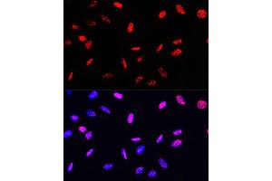 Immunofluorescence analysis of U-2 OS cells using Phospho-Histone H3-T45 Rabbit pAb (ABIN7267692) at dilution of 100 (40x lens).