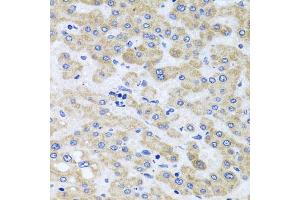 Immunohistochemistry of paraffin-embedded human liver injury using PEX3 antibody (ABIN5975508) at dilution of 1/100 (40x lens). (PEX3 anticorps)