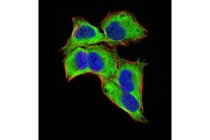 Immunofluorescence analysis of Hela cells using GLI1 mouse mAb (green). (GLI1 anticorps  (AA 284-449))