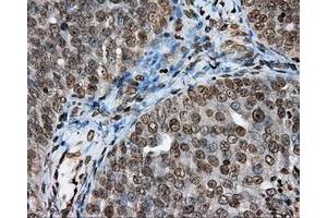 Immunohistochemical staining of paraffin-embedded Kidney tissue using anti-DAPK2 mouse monoclonal antibody.