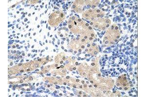 anti-Ribonuclease H2, Subunit A (RNASEH2A) (C-Term) antibody