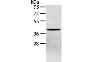 Western Blot analysis of Hepg2 cell using PTX3 Polyclonal Antibody at dilution of 1:400 (PTX3 anticorps)