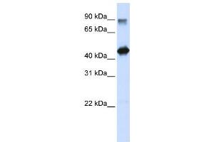 Western Blotting (WB) image for anti-High-Mobility Group 20A (HMG20A) antibody (ABIN2458385) (HMG20A anticorps)