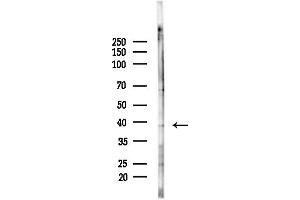 anti-Dual Specificity Phosphatase 11 (RNA/RNP Complex 1-Interacting) (DUSP11) (N-Term) antibody