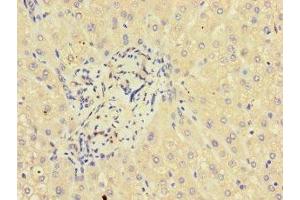 Immunohistochemistry of paraffin-embedded human liver tissue using ABIN7154242 at dilution of 1:100 (GLT8D1 anticorps  (AA 33-332))