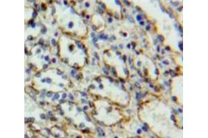 Used in DAB staining on fromalin fixed paraffin-embedded Spleen tissue