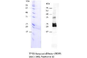 Image no. 1 for TP53 Apoptosis Effector (PERP) (AA 1-193) protein (Strep Tag) (ABIN3105096) (PERP Protein (AA 1-193) (Strep Tag))