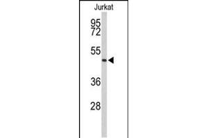 Western blot analysis of ACR Antibody (C-term) (ABIN653021 and ABIN2842643) in Jurkat cell line lysates (35 μg/lane). (Acrosin anticorps  (C-Term))