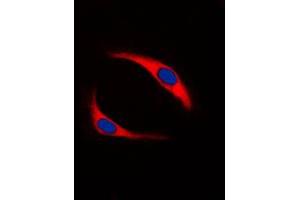 Immunofluorescent analysis of SYK (pY323) staining in Ramos cells.