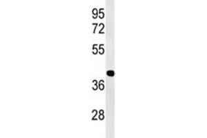 Western blot analysis of ATF1 antibody and Jurkat lysate