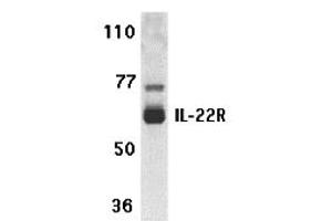 Western Blotting (WB) image for anti-Interleukin 22 Receptor (IL22R) (N-Term) antibody (ABIN1031411) (IL22R anticorps  (N-Term))