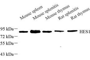 Western blot analysis of HS1 (ABIN7074187) at dilution of 1: 500 (HCLS1 anticorps)