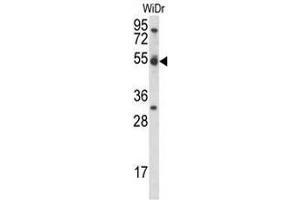 CCNI Antibody (C-term) western blot analysis in WiDr cell line lysates (35µg/lane).